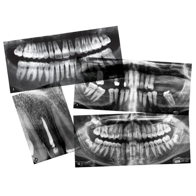 Roylco Dental X-Rays 4 Roylco Dental X-Rays - Image 2